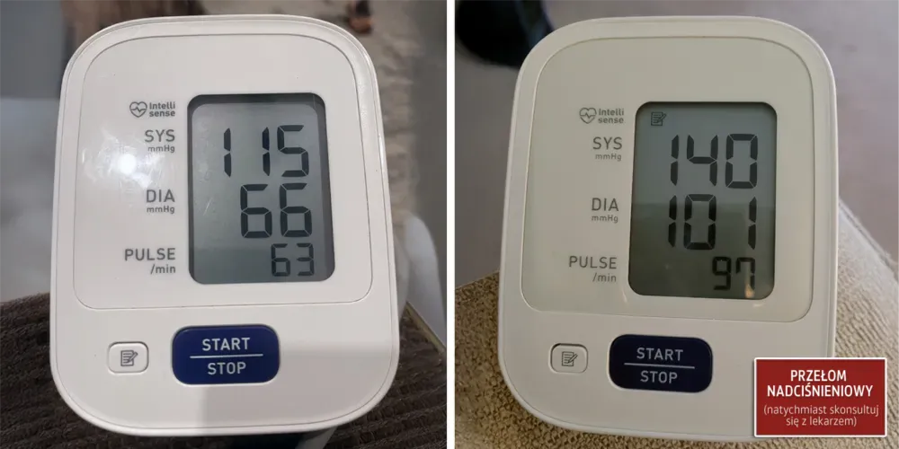 Derila sleep apnea 2 hypertensive crisis C SM PL