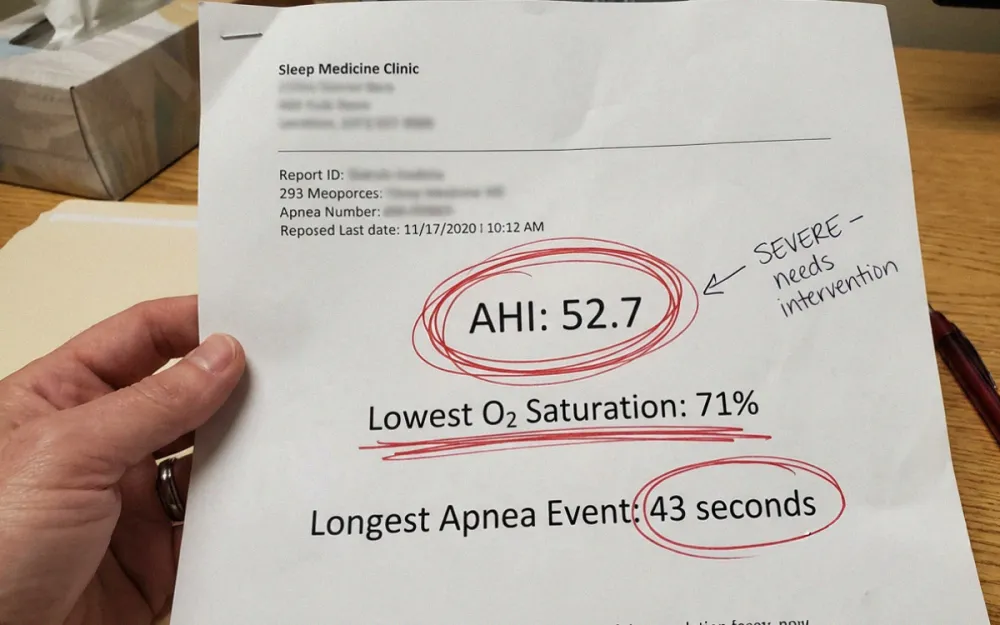 25W50 Sleep Apnea TSL2 Asset 02