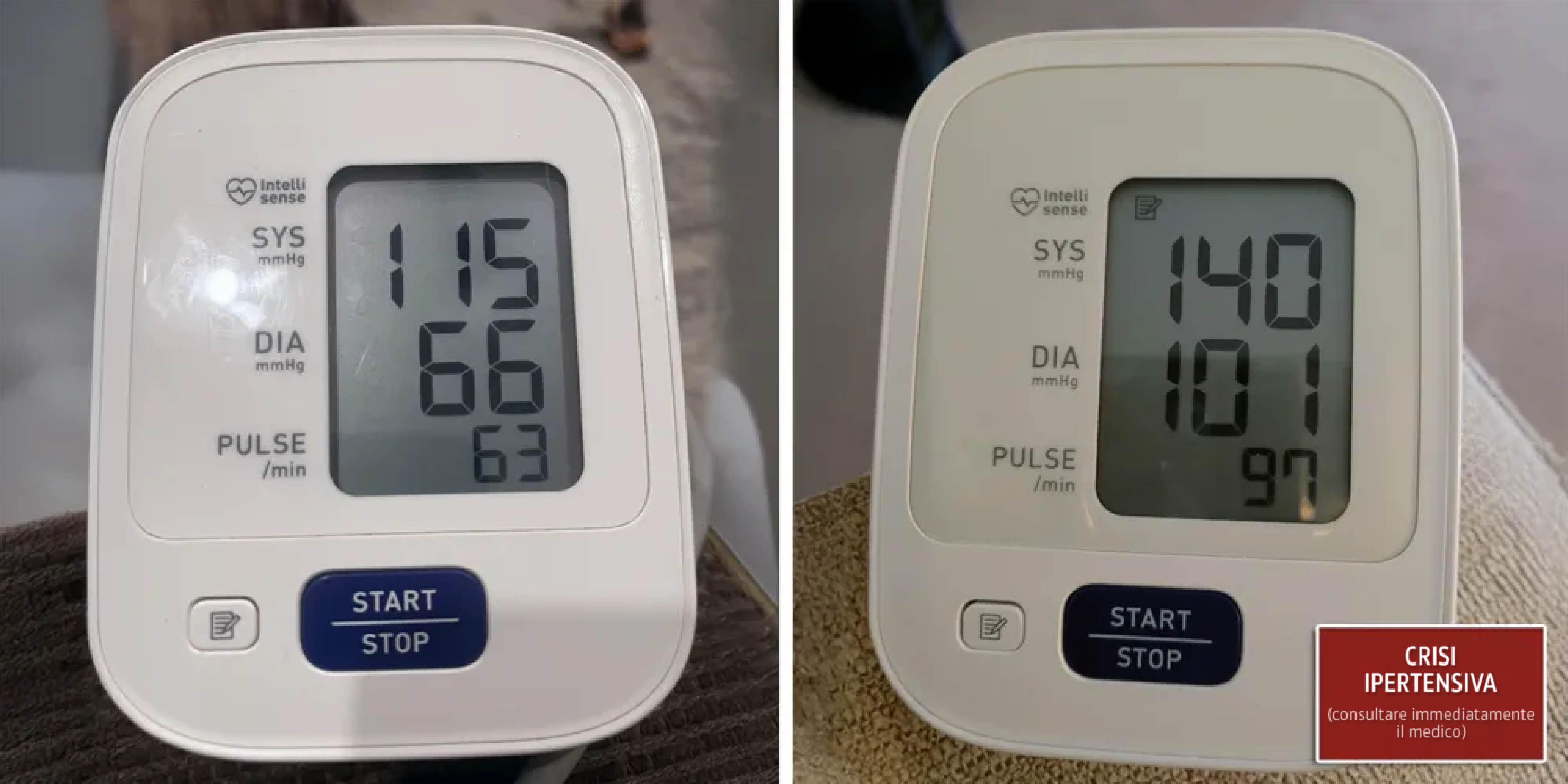 Derila sleep apnea 2 hypertensive crisis C SM IT